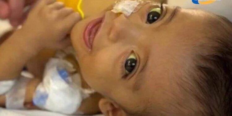 Camilo superó la cirugía de trasplante de hígado y las próximas horas son clave